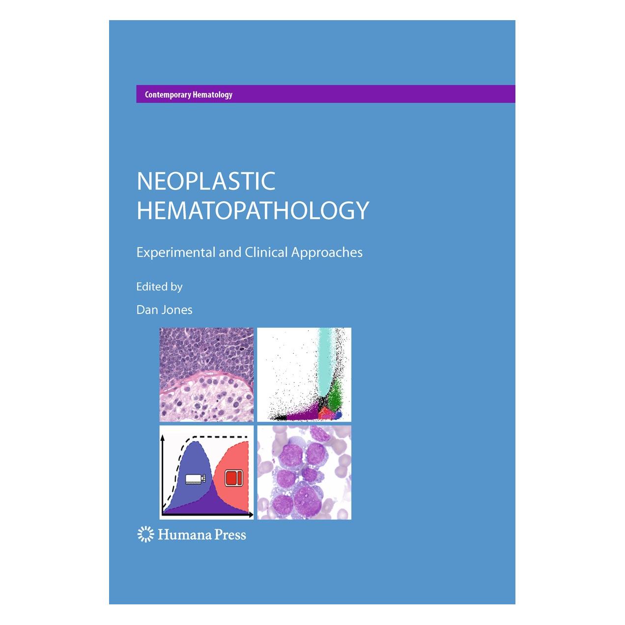 Humana Press Neoplastic Hematopathology (Englisch, Hardcover, Dan Jones) (9781607613831)