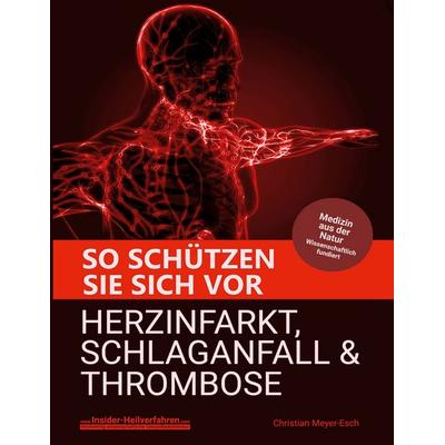 So schützen Sie sich vor Herzinfarkt, Schlaganfall und Thrombose, Taschenbuch von Christian Meyer-Esch, BoD – Books on Demand, 978-3-7597-5968-9