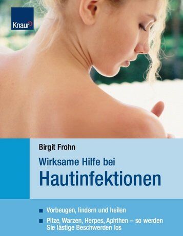 Birgit Frohn - Wirksame Hilfe bei Hautinfektionen: Vorbeugen, lindern, heilen Pilze, Warzen, Herpes, Aphten - so werden Sie lästige Beschwerden los - Preis vom 12.10.2026 11:37:12 h