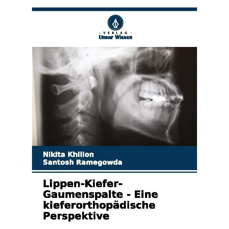 Bod Lippen-Kiefer-Gaumenspalte - Eine kieferorthopädische Perspektive (63589233)