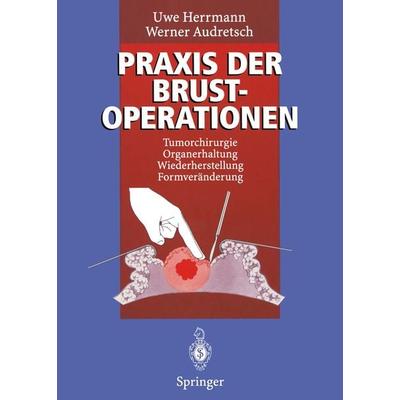 Praxis der Brustoperationen, Taschenbuch von Uwe Herrmann,Werner Audretsch, Springer Berlin, 978-3-642-79609-8