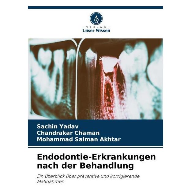 Unser Wissen Endodontie-Erkrankungen nach der Behandlung (57092793)