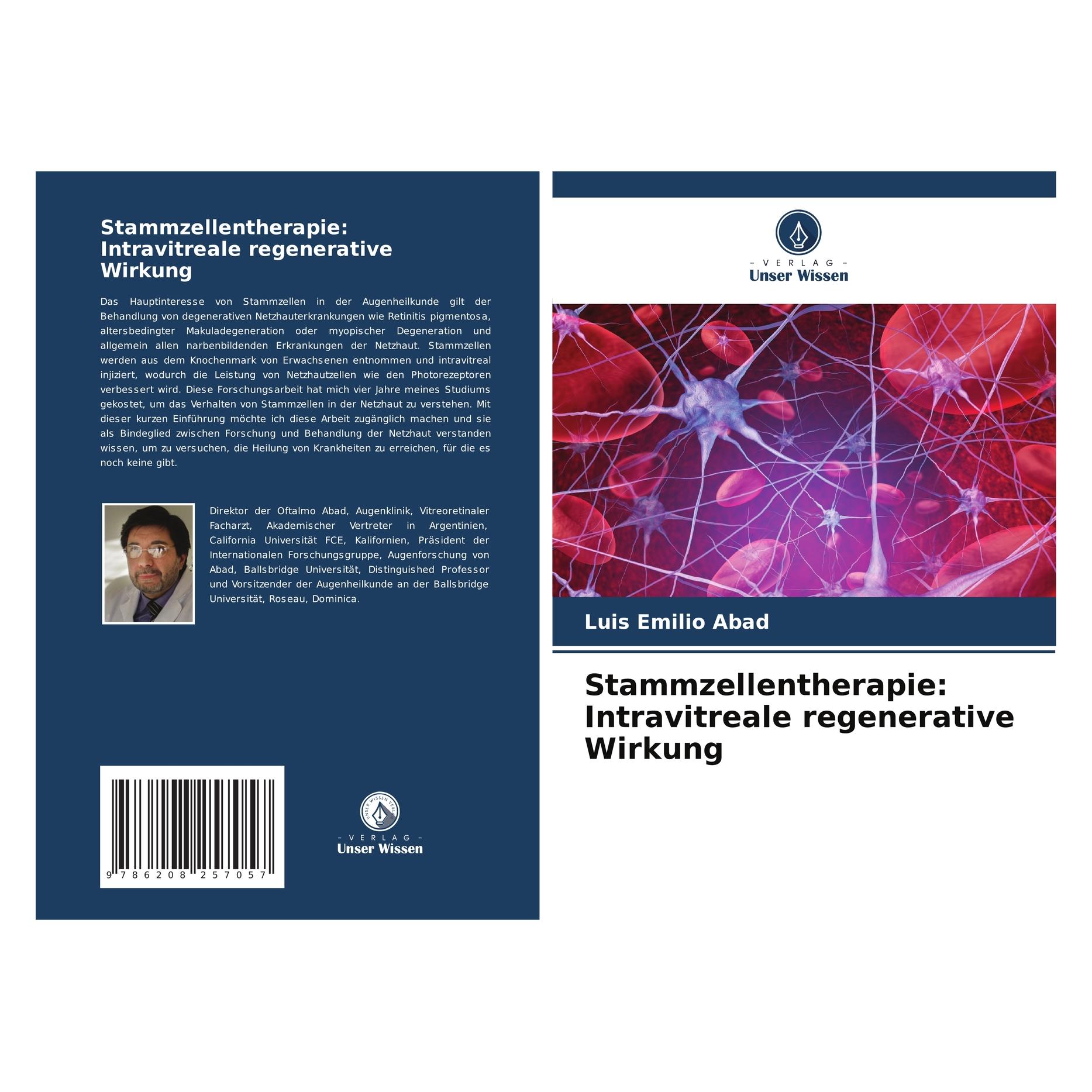 Unser Wissen Stammzellentherapie: Intravitreale regenerative Wirkung (107 g) (57152977)