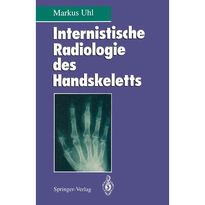 Internistische Radiologie des Handskeletts, Taschenbuch von Markus Uhl, Springer Berlin, 978-3-540-58191-8