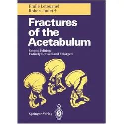 Fractures of the Acetabulum, Fachbücher von Robert Judet, Emile Letournel