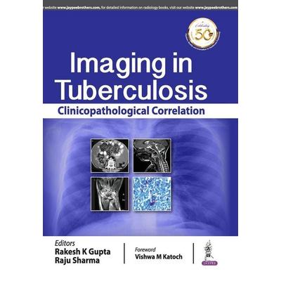 Imaging in Tuberculosis, Taschenbuch von Rakesh K. Gupta,Raju Sharma, Jaypee Brothers Medical Publishers P Ltd, 978-93-88958-97-4