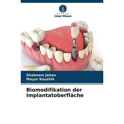 Biomodifikation der Implantatoberfläche, Taschenbuch von Shabnam Jahan,Mayur Kaushik, Verlag Unser Wissen, 978-620-6-86981-8