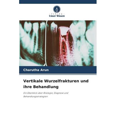 Vertikale Wurzelfrakturen und ihre Behandlung, Taschenbuch von Charutha Arun, Verlag Unser Wissen, 978-620-9-56444-4