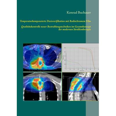 Temperaturkompensierte Dosisverifikation mit Radiochromem Film, Gebundene Ausgabe von , BoD – Books on Demand, 978-3-8448-1066-0