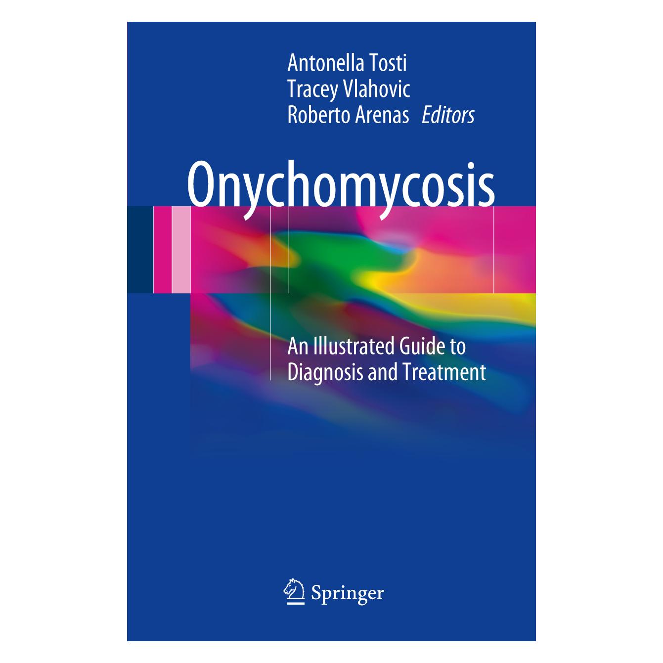 Springer Onychomycosis (Englisch, Softcover, Antonella Tosti, Roberto Arenas, Tracey C. Vlahovic) (55829399)