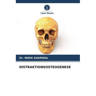 Distraktionsosteogenese, Taschenbuch von Nidhi Agarwal, Verlag Unser Wissen, 978-620-5-18430-1