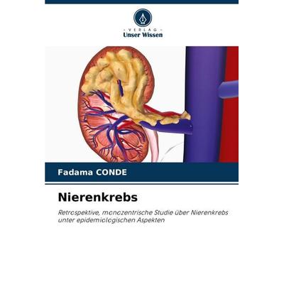 Nierenkrebs, Taschenbuch von Fadama Conde, Verlag Unser Wissen, 978-620-2-00295-0