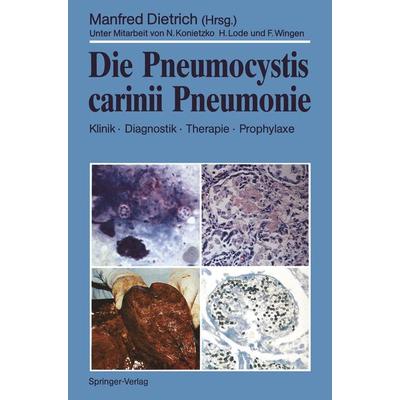 Die Pneumocystis carinii Pneumonie, Taschenbuch von , Springer Berlin, 978-3-540-51177-9
