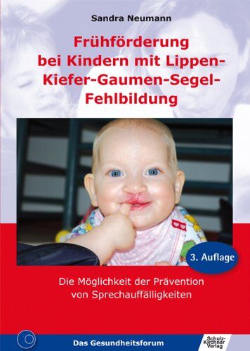 Sandra Neumann - Frühförderung bei Kindern mit Lippen-Kiefer-Gaumen-Segel-Fehlbildung - Preis vom 16.10.2026 11:41:07 h