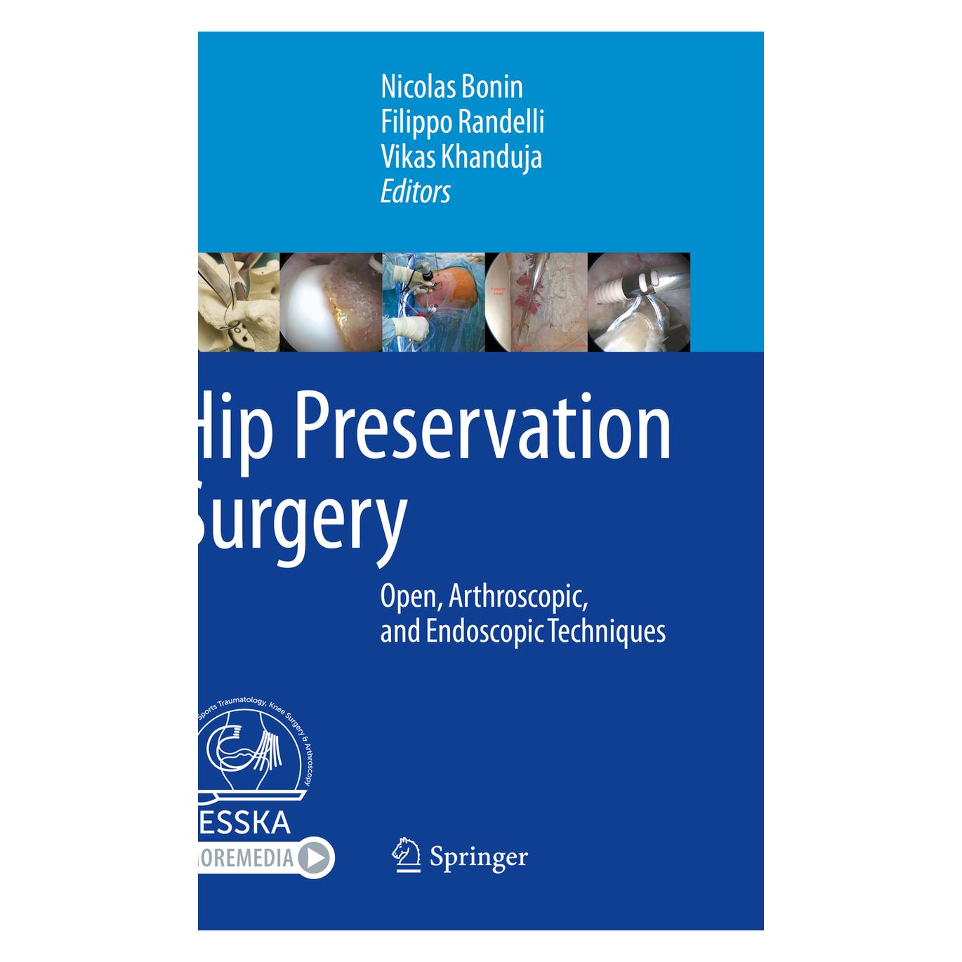 Springer Hip Preservation Surgery (Englisch, Softcover, Filippo Randelli, Nicolas Bonin, Vikas Khanduja) (56196153)