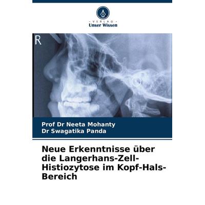 Neue Erkenntnisse über die Langerhans-Zell-Histiozytose im Kopf-Hals-Bereich, Taschenbuch von Neeta Mohanty,Swagatika Panda, Verlag Unser Wissen,