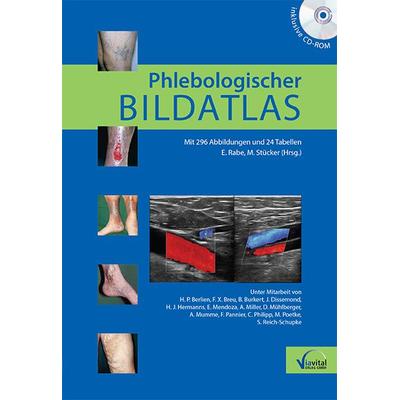 Phlebologischer Bildatlas, Set von , WPV. Wirtschafts- und Praxisverlag, 978-3-934371-52-1