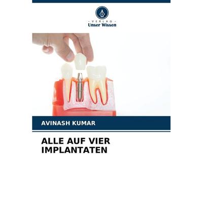 Alle Auf vier Implantaten, Taschenbuch von Avinash Kumar, Verlag Unser Wissen, 978-620-8-30040-1