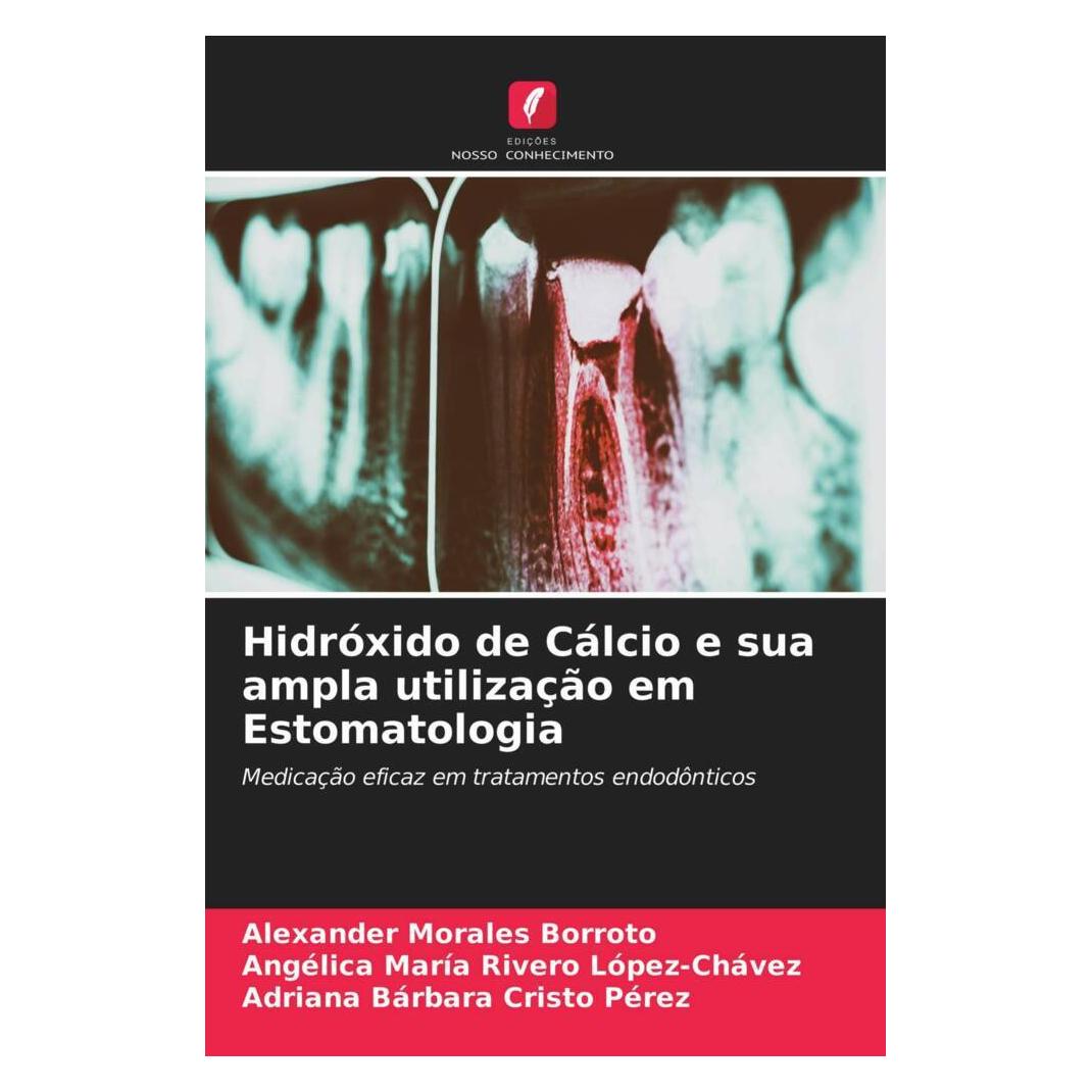 Edicoes Nosso Conhecimento Hidróxido de Cálcio e sua ampla utilização em Estomatologia (Softcover, Adriana Bárbara Cristo Pérez, Alexander Morales Borroto, Angélica María Rivero López-Chávez) (56178119)
