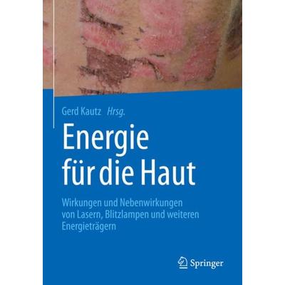 Energie für die Haut, Gebundene Ausgabe von , Springer Berlin, 978-3-662-56435-6