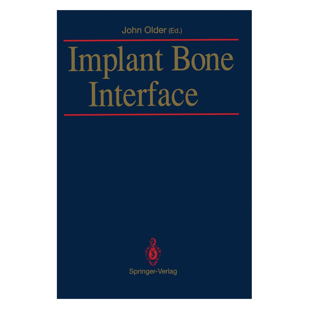 Springer Implant Bone Interface (Englisch, Softcover, John Older) (55532992)