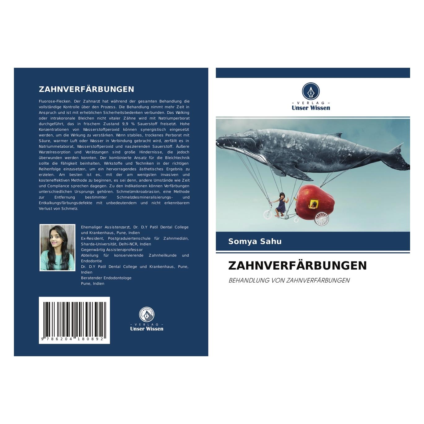 Unser Wissen Zahnverfärbungen (56240881)