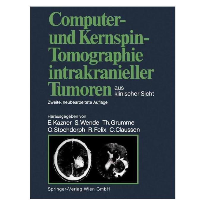 Springer Computer- und Kernspin-Tomographie intr (Deutsch, 2014) (55551496)