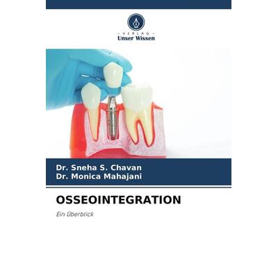 OSSEOINTEGRATION, Taschenbuch von Sneha S. Chavan,Monica Mahajani, Verlag Unser Wissen, 978-620-4-94077-9