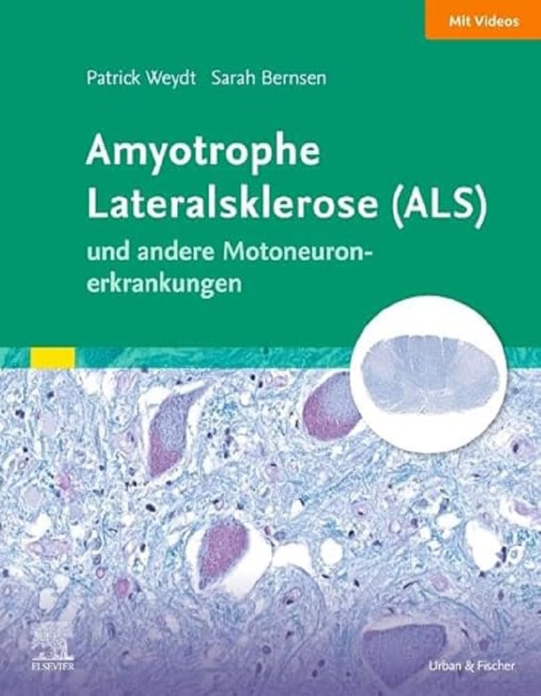Patrick Weydt - Amyotrophe Lateralsklerose (ALS) und andere Motoneuronerkrankungen: Das Wichtigste für Ärztinnen und Ärzte aller Fachrichtungen (Elsevier Essentials) - Preis vom 10.10.2026 11:48:34 h