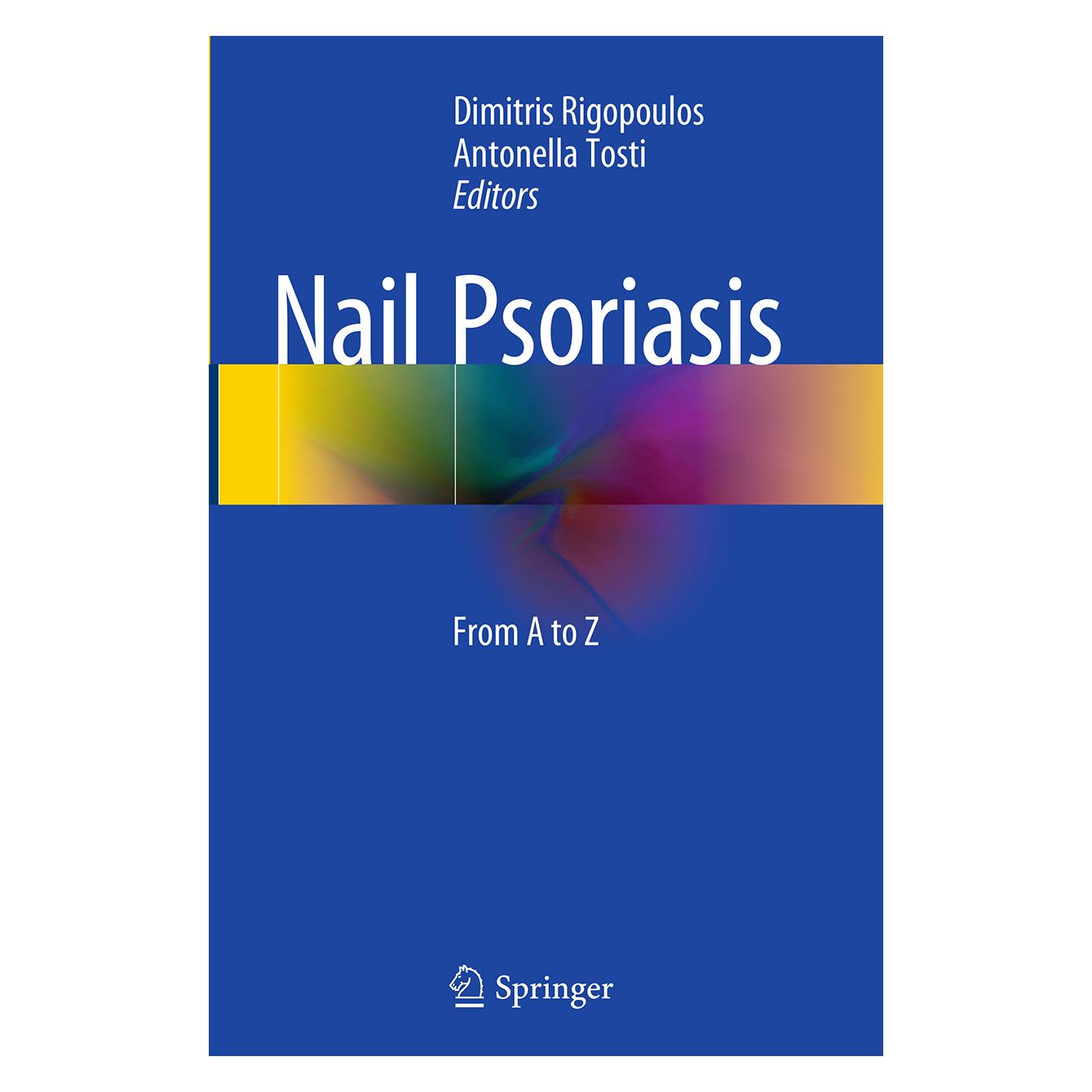 Springer Nail Psoriasis (Englisch, Softcover, Antonella Tosti, Dimitris Rigopoulos) (55827832)