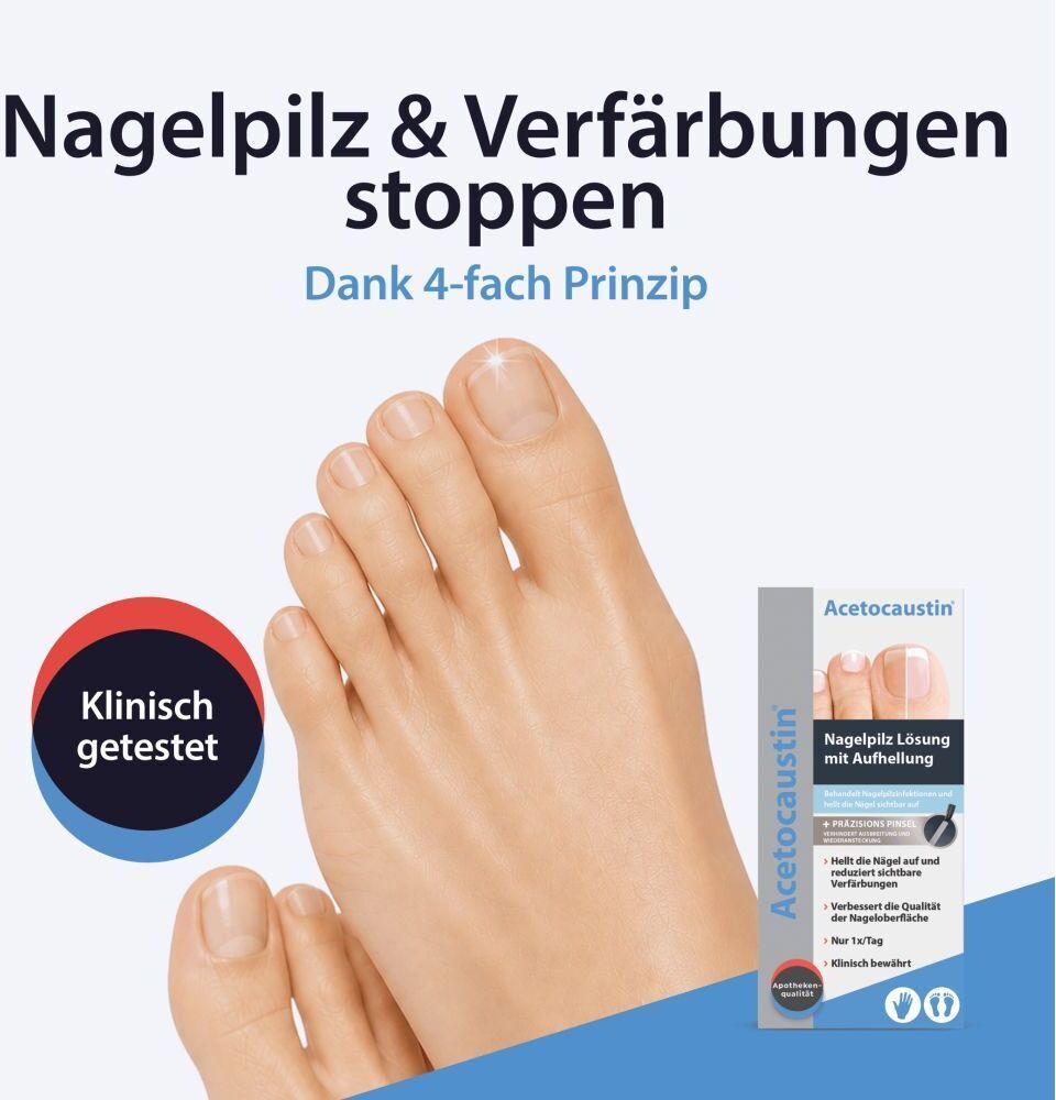 Acetocaustin Nagelpilz Lösung mit Aufhellung 9 ml