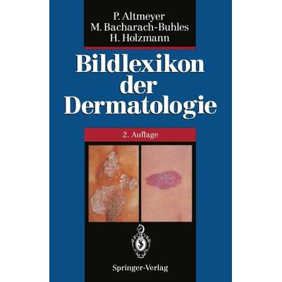 Bildlexikon der Dermatologie, Taschenbuch von Peter Altmeyer,Martina Bacharach-Buhles,Hans Holzmann, Springer Berlin, 978-3-642-78548-1