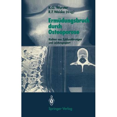 Ermüdungsbruch durch Osteoporose, Taschenbuch von , Springer Berlin, 978-3-540-51444-2