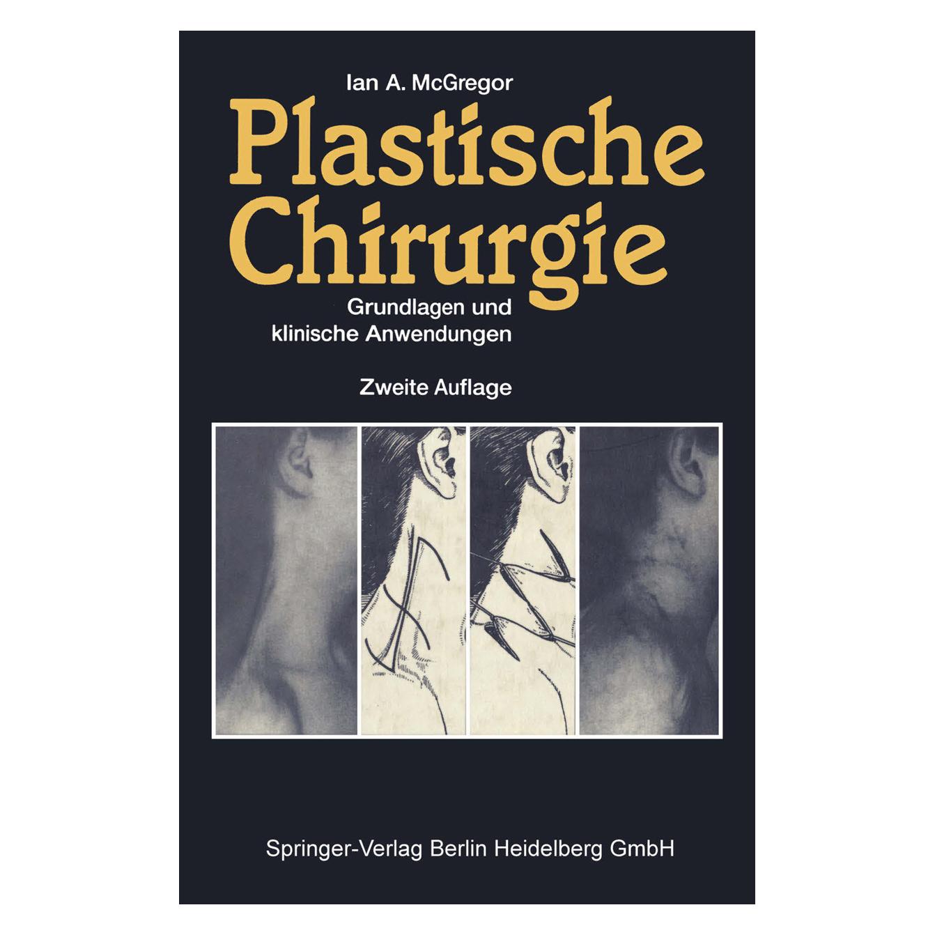 Springer Plastische Chirurgie (Deutsch, Softcover, Ian A McGregor) (35147195)