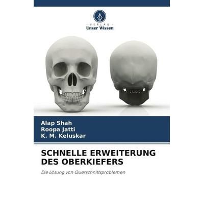 SCHNELLE ERWEITERUNG DES OBERKIEFERS, Taschenbuch von Alap Shah,Roopa Jatti,K. M. Keluskar, Verlag Unser Wissen, 978-620-5-31536-1