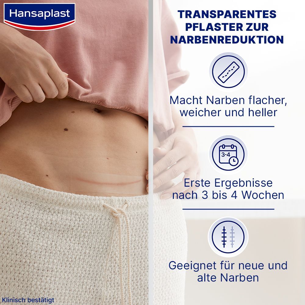 Hansaplast Pflaster zur Behandlung von Narben XL 21 St