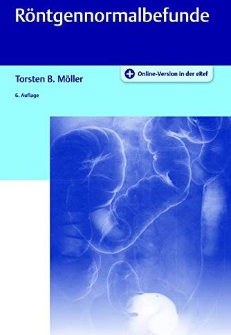 Möller, Torsten Bert - Röntgennormalbefunde - Preis vom 13.10.2026 11:25:28 h