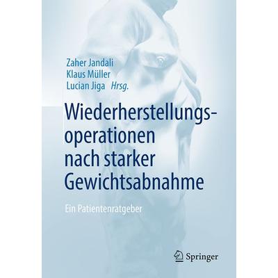 Wiederherstellungsoperationen nach starker Gewichtsabnahme, Taschenbuch von , Springer Berlin, 978-3-662-57381-5