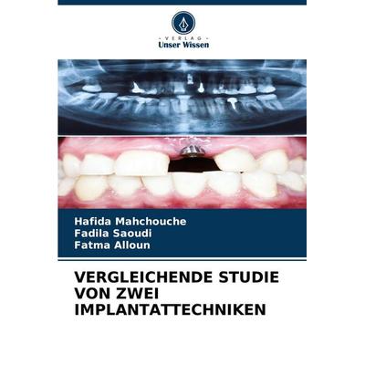 VERGLEICHENDE STUDIE VON ZWEI IMPLANTATTECHNIKEN, Taschenbuch von Hafida Mahchouche,Fadila Saoudi,Fatma Alloun, Verlag Unser Wissen, 978-620-6-65961-7