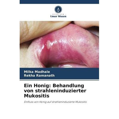 Ein Honig: Behandlung von strahleninduzierter Mukositis, Taschenbuch von Milka Madhale,Rekha Ramanath, Verlag Unser Wissen, 978-620-5-43083-5