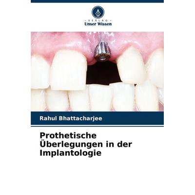 Prothetische Überlegungen in der Implantologie, Taschenbuch von Rahul Bhattacharjee, Verlag Unser Wissen, 978-620-7-98986-7