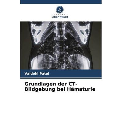 Grundlagen der CT-Bildgebung bei Hämaturie, Taschenbuch von Vaidehi Patel, Verlag Unser Wissen, 978-620-4-52244-9