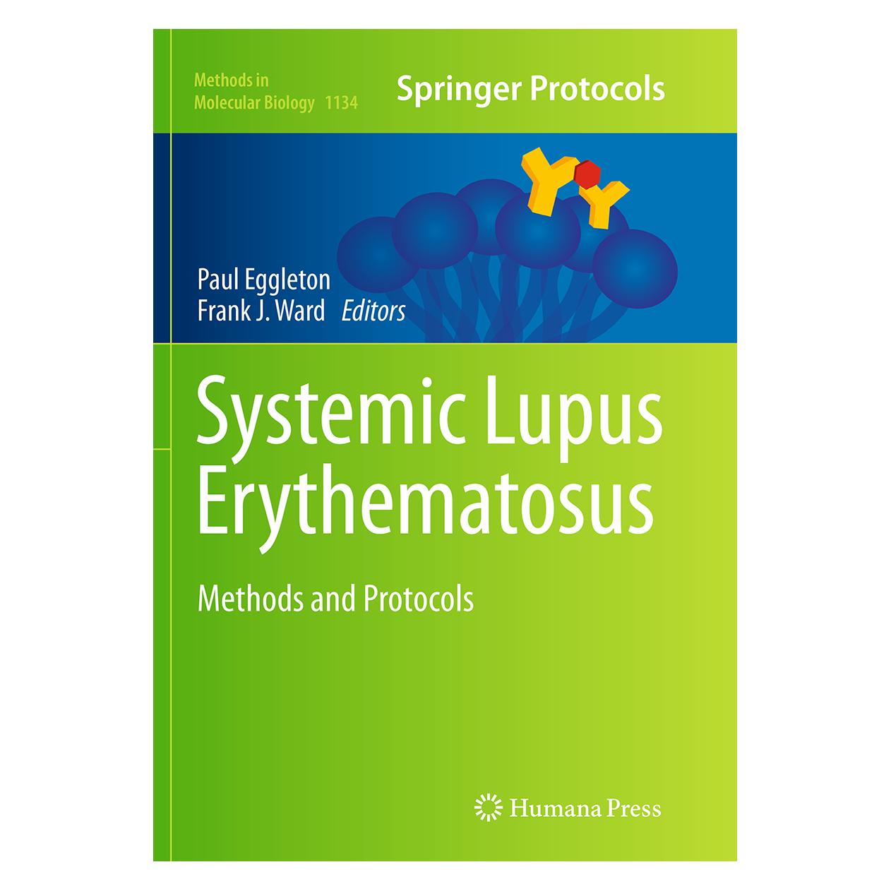 Springer Systemic Lupus Erythematosus (Englisch, Softcover, Frank J. Ward, Paul Eggleton) (55833729)