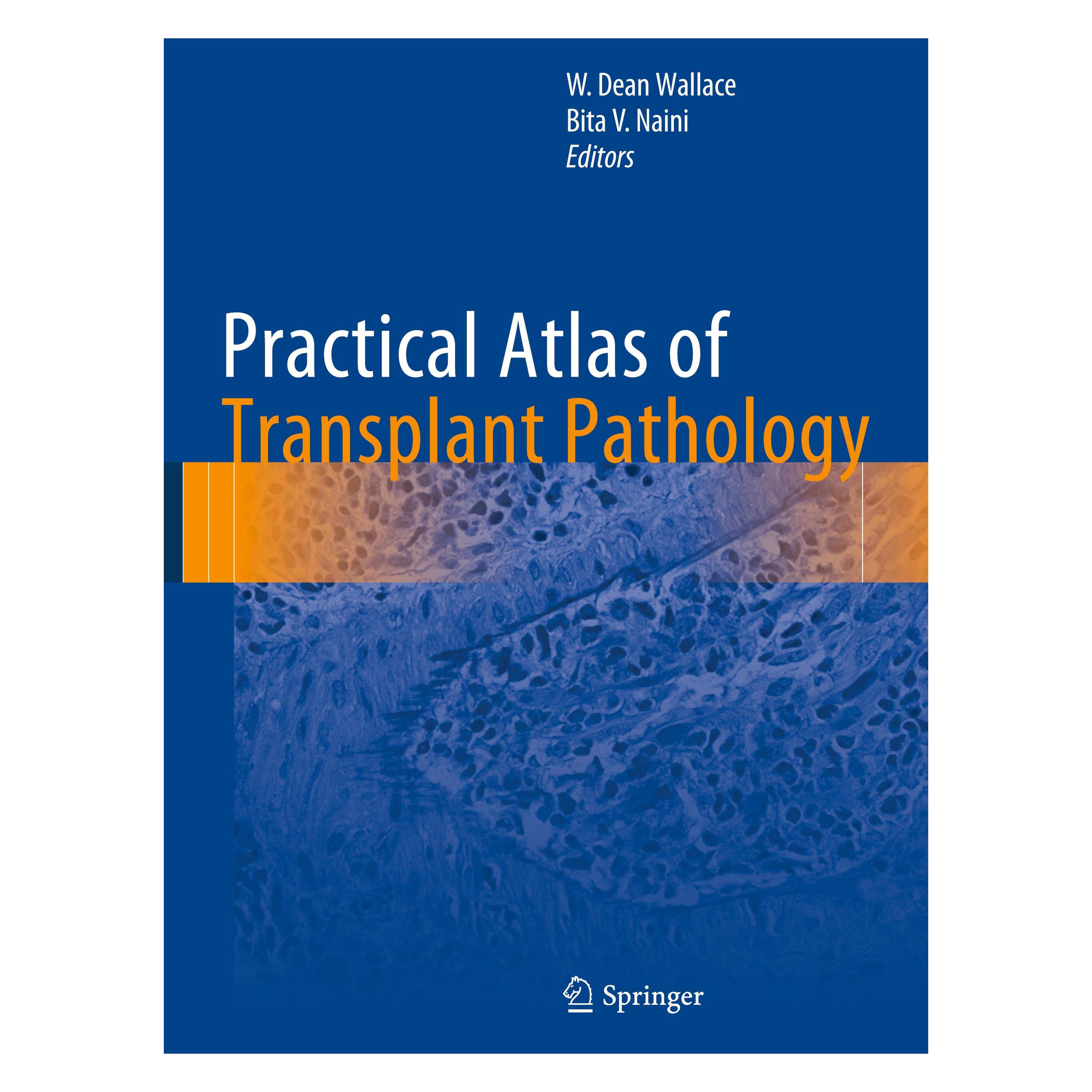 Springer Practical Atlas of Transplant Pathology (Englisch, Hardcover, Bita V. Naini, W. Dean Wallace) (978-3-319-23053-5)