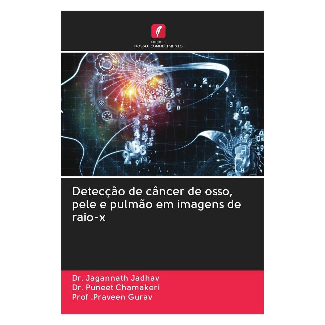 Edicoes Nosso Conhecimento Detecção de câncer de osso, pele e pulmão em imagens de raio-x (Portugiesisch, Softcover, Dr. Jagannath Jadhav, Dr. Puneet Chamakeri, Praveen Gurav) (56159554)