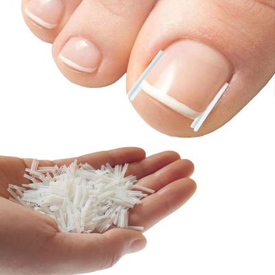 Discount Dollar Deals Ingrown Toenail Corrector Kit Nail Brace Filling Pad For Pain Relief Ingrown Toenail Corrector Kit Nail Brace Filling Pad For Pain Relief