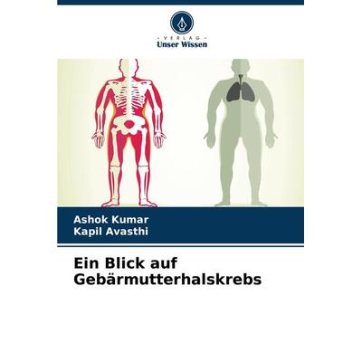 Ein Blick auf Gebärmutterhalskrebs, Taschenbuch von Ashok Kumar,Kapil Avasthi, Verlag Unser Wissen, 978-620-7-86314-3