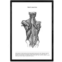 POSTER Anatomie Muskeln & Knochen Rücken A4 Schwarzer Rahmen