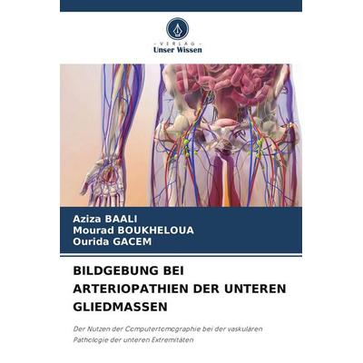 Bildgebung bei Arteriopathien der Unteren Gliedmassen, Taschenbuch von Aziza Baali,Mourad Boukheloua,Ourida Gacem, Verlag Unser Wissen,