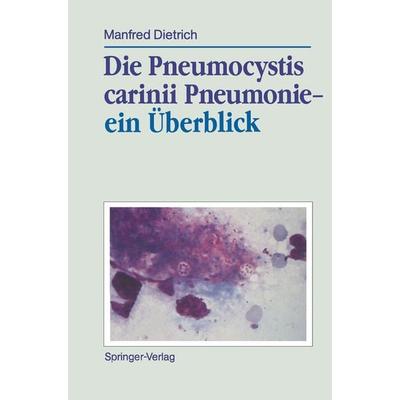 Die Pneumocystis carinii Pneumonie— ein Überblick, Taschenbuch von Manfred Dietrich, Springer Berlin, 978-3-540-51233-2